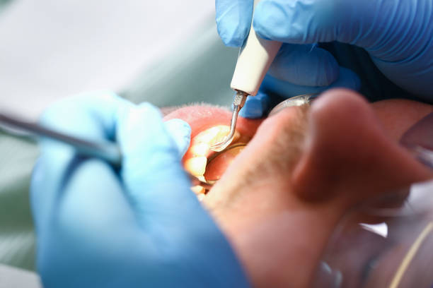 Best Dentist for Tooth Abscess  in Olivet, MI