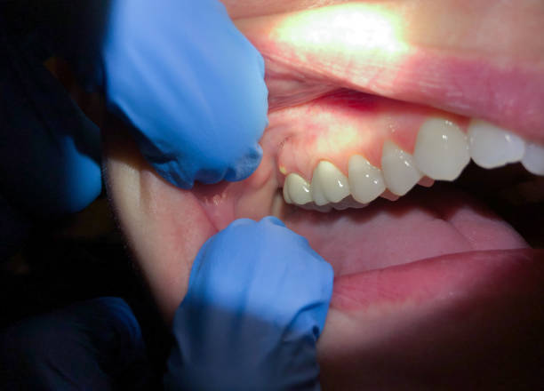 Best Emergency Dental Services Near Me  in Olivet, MI