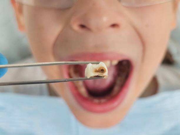 Best Teeth Whitening  in Olivet, MI